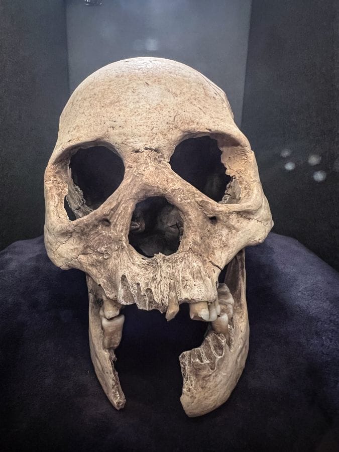 Omiya Museum of History and Folklore skull